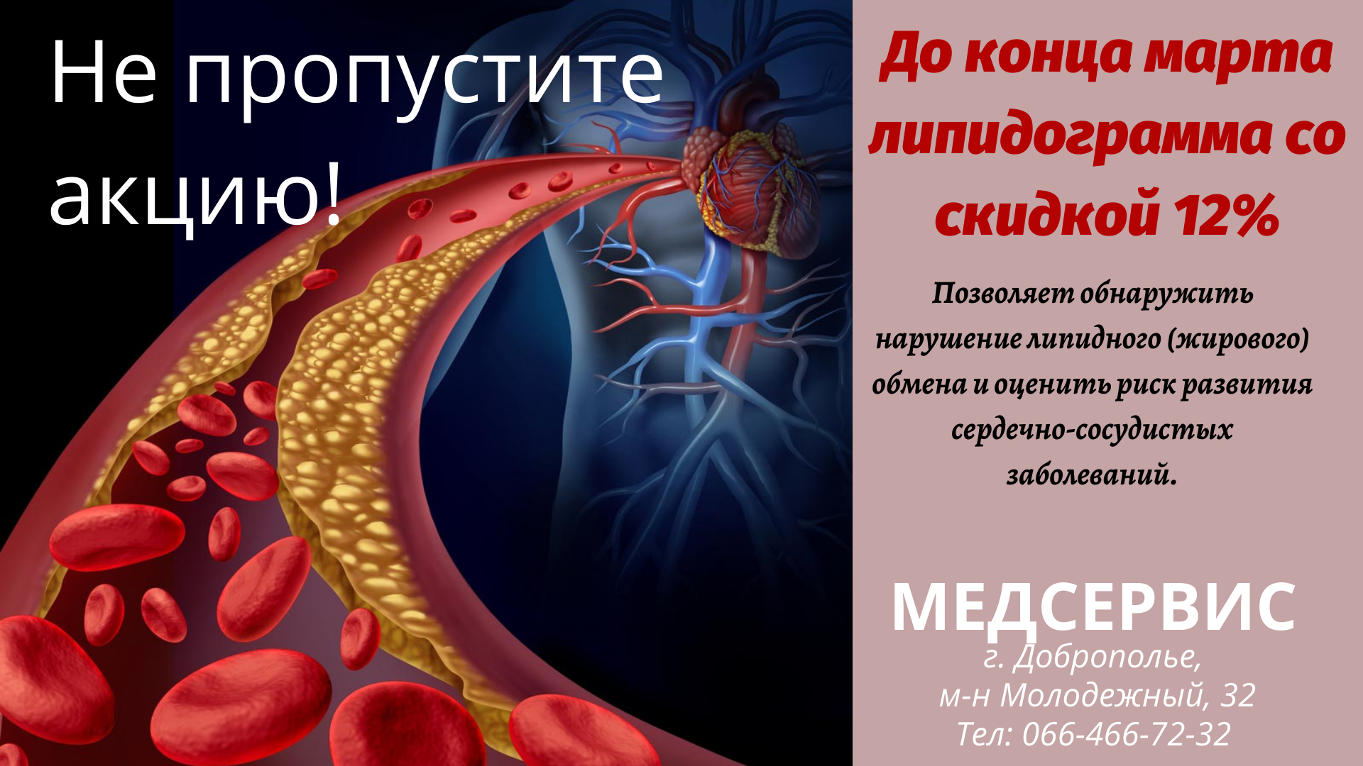 Липидограмма по специальной цене - ООО «МЕДСЕРВИС», ЛЕЧЕБНО-ДИАГНОСТИЧЕСКИЙ  ЦЕНТР в Доброполье