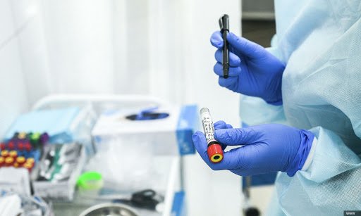Число случаев растет: в Украине 11 226 новых COVID-заражений