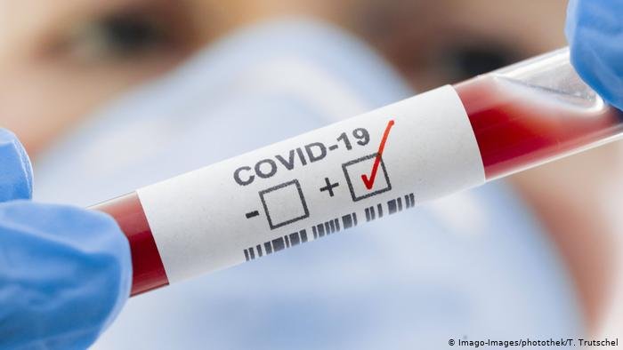 Статистику по COVID-19 в Донецкой области пополнили 686 больных и 19 умерших