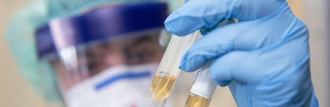 В Украине выявлено 1045 новых случаев COVID-19