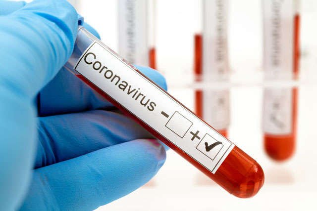 Минздрав обновил COVID-статистику: 756 новых случаев за сутки